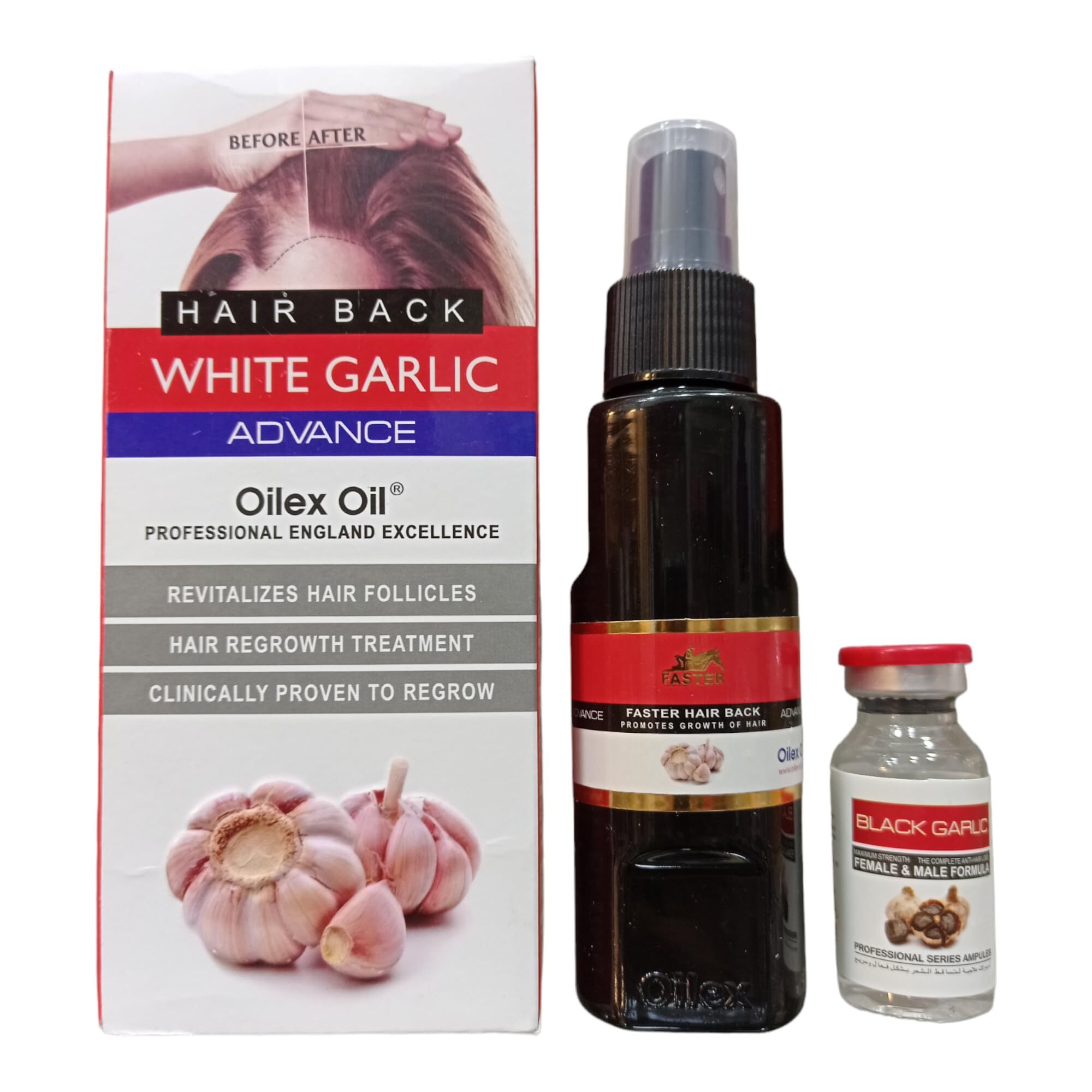 فاستر ادفانس زيت الشعر بالثوم الابيض 100 مل